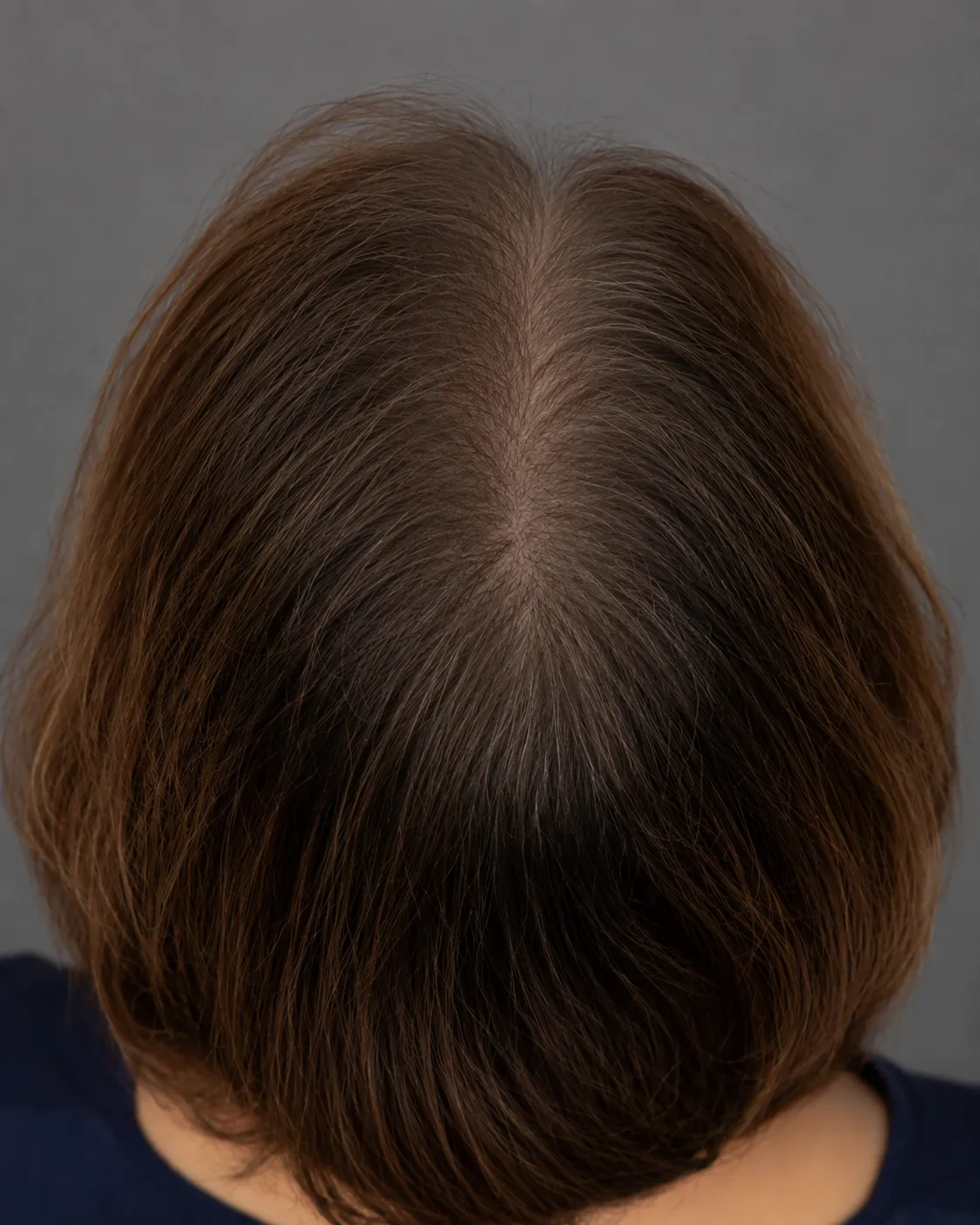 After treatment sample image 1