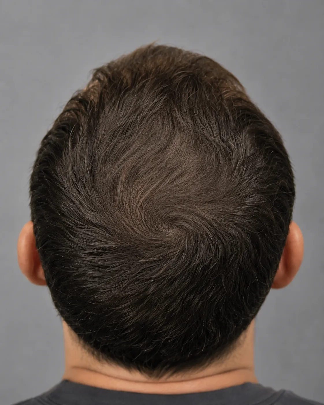 After treatment sample image 2